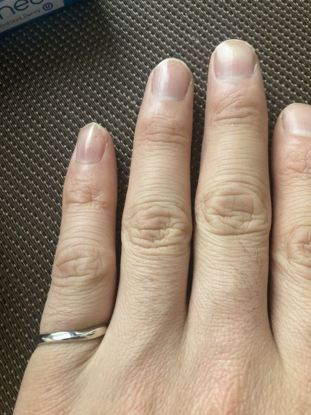 とてもいい指輪を選んでいただきました。