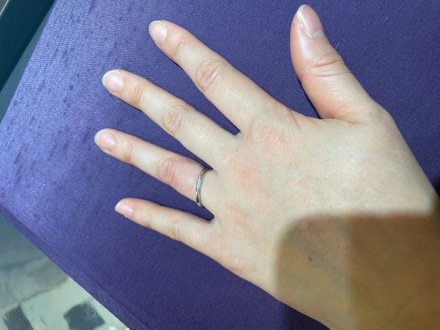 きらという指輪です