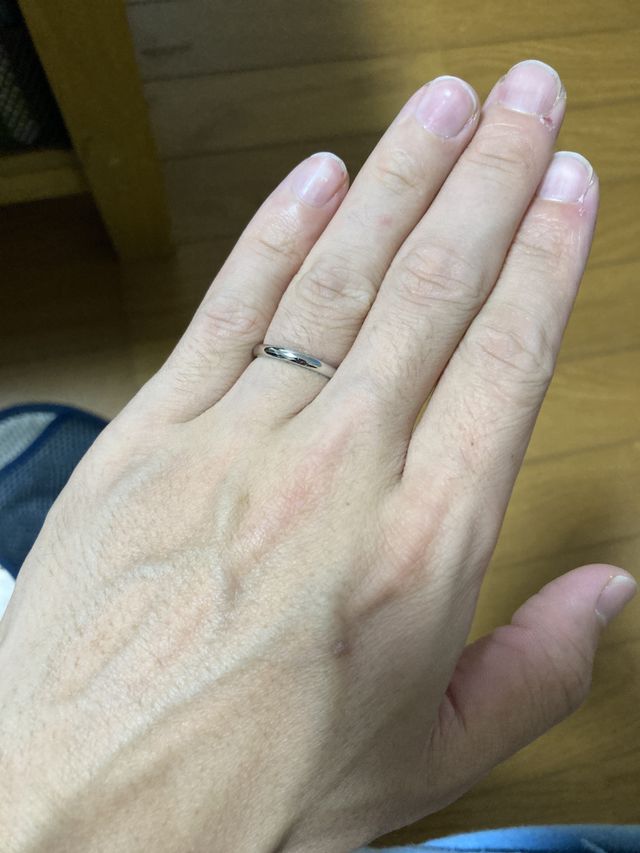 左指の薬指についてます。
中指の傷は先日甘皮を剥いた時に着い