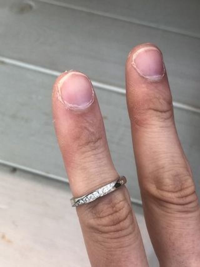 手作り感のある可愛い指輪