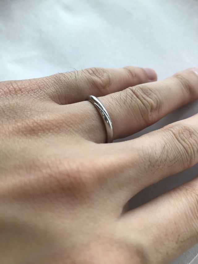 指輪をはめてから、８か月目の状態です。