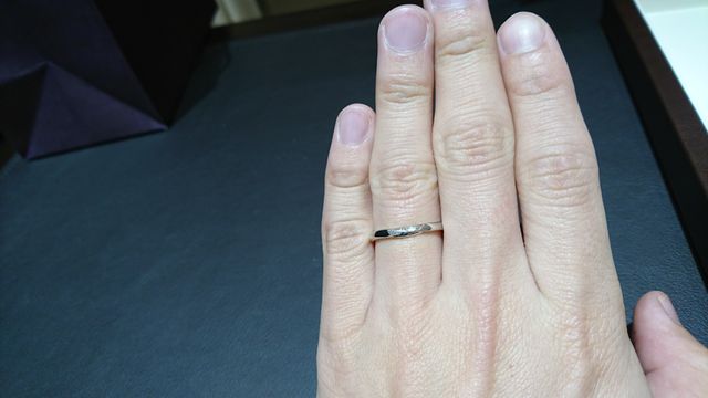 男性側も中心に緩やかなＶ字のねじれがあります。