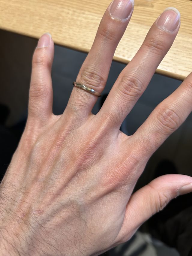 指輪の写真