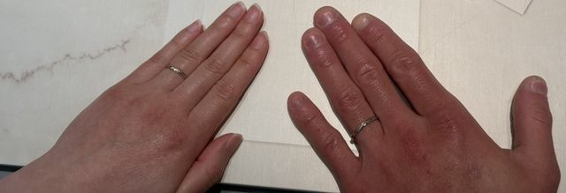 指輪を着用している写真