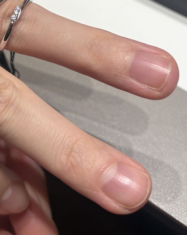 中心にダイヤモンドがあるもの