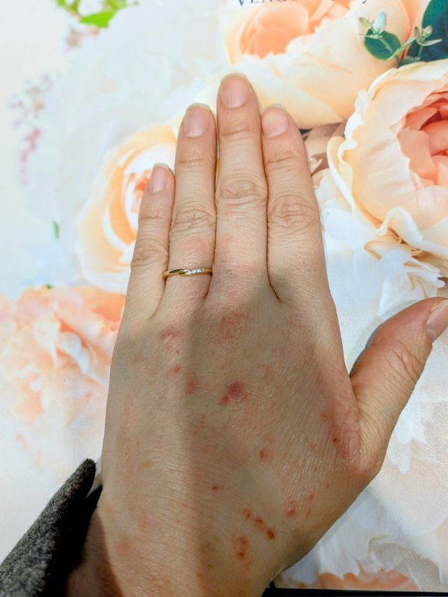 素材はピンクゴールド。