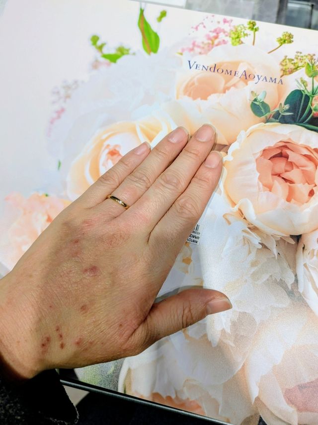 1石。表面のぷっくり感が関節を目立ちにくくしてくれる。