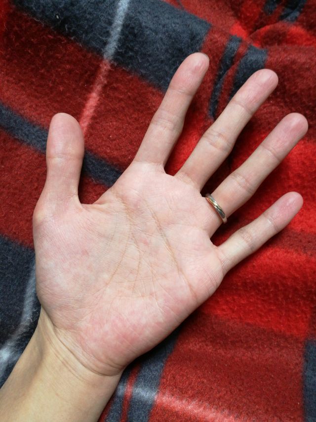 ずっと着けているので細かい傷は多数有り