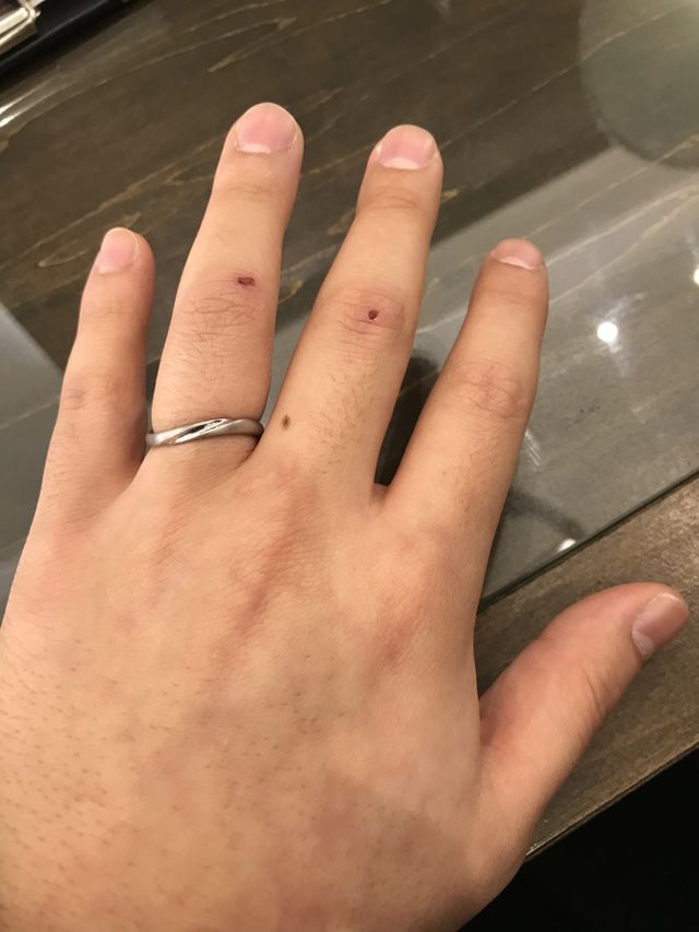 ひねりがあってほかの指輪とは一味違いました！