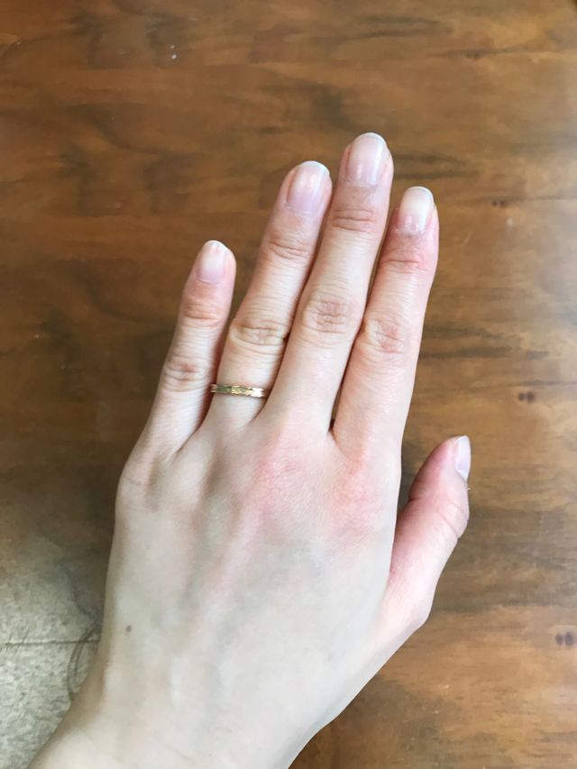 私はピンクゴールドです。