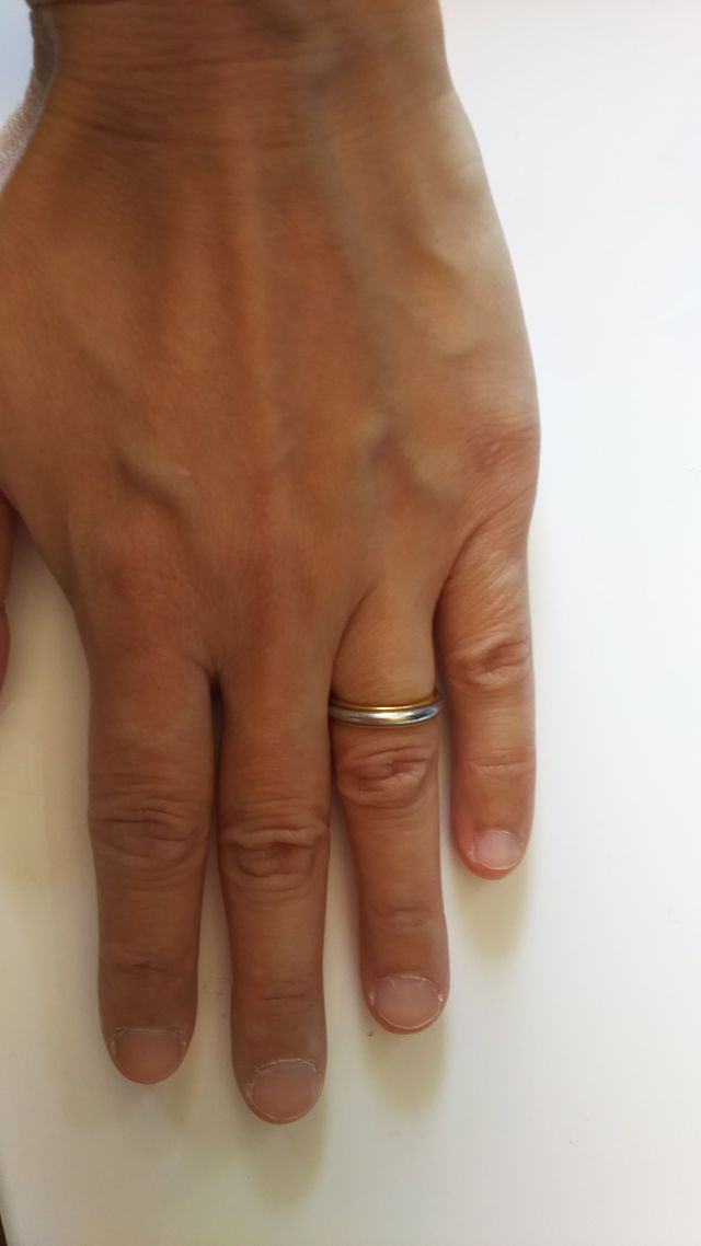 結婚指輪です