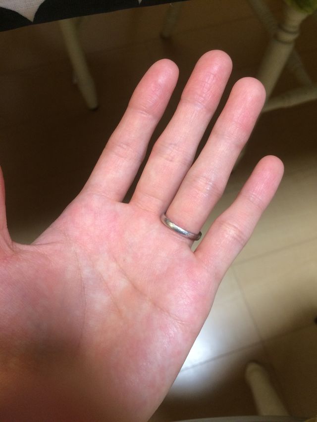 手のひら側にはダイヤがありません。