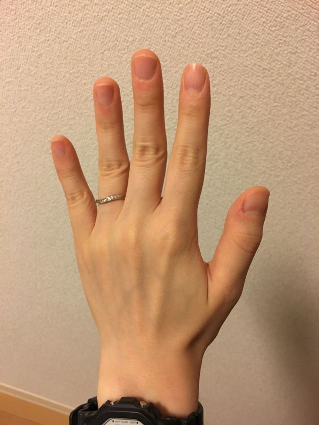 アルチェステ（女）