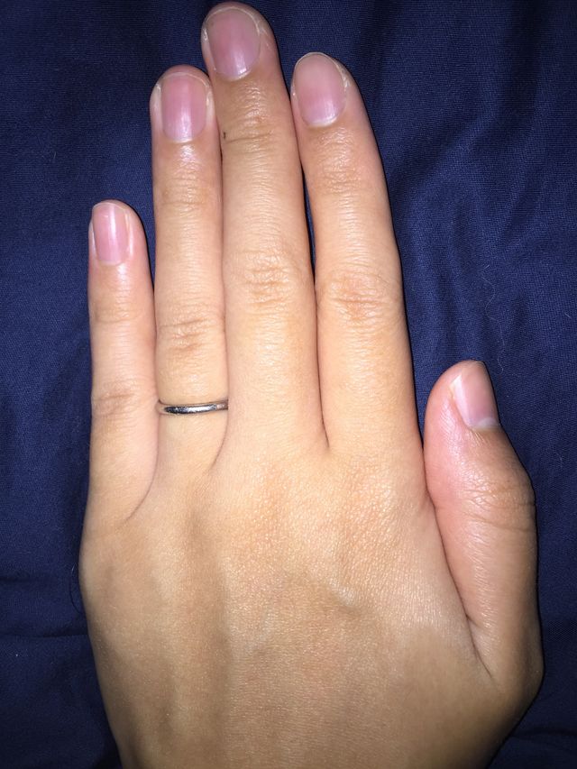 使用後一年です。