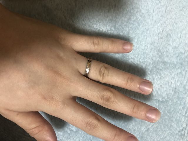 指輪の着画です。産後なので少し浮腫んでます。