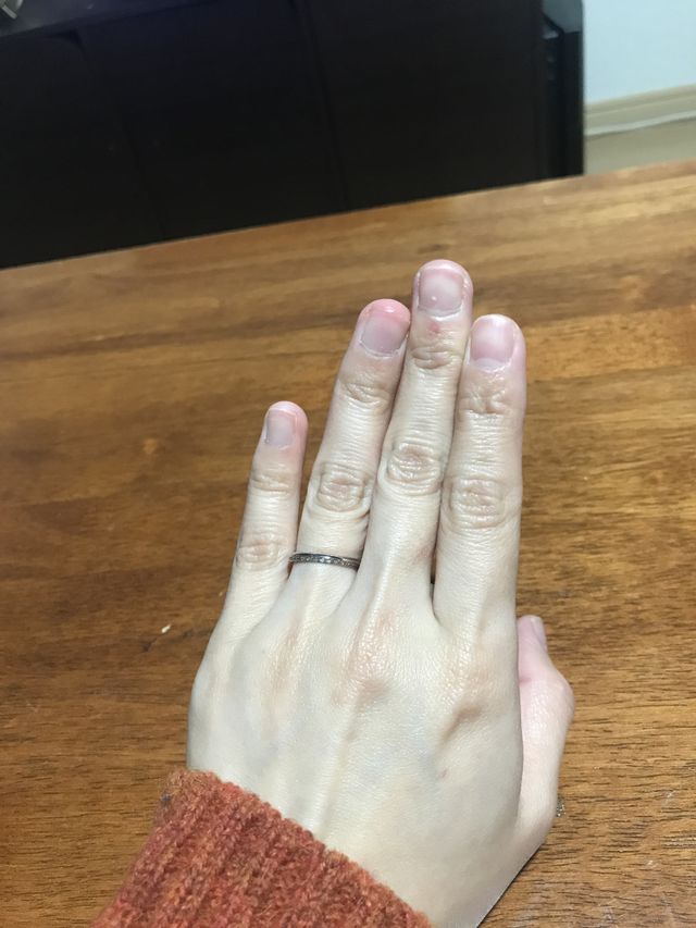 結婚指輪。上下で付け替えられるタイプです。