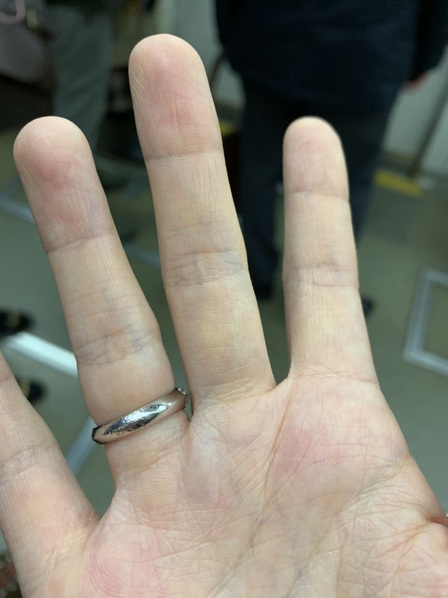 5回程の着用で凸凹の無数の傷ができショックでした。