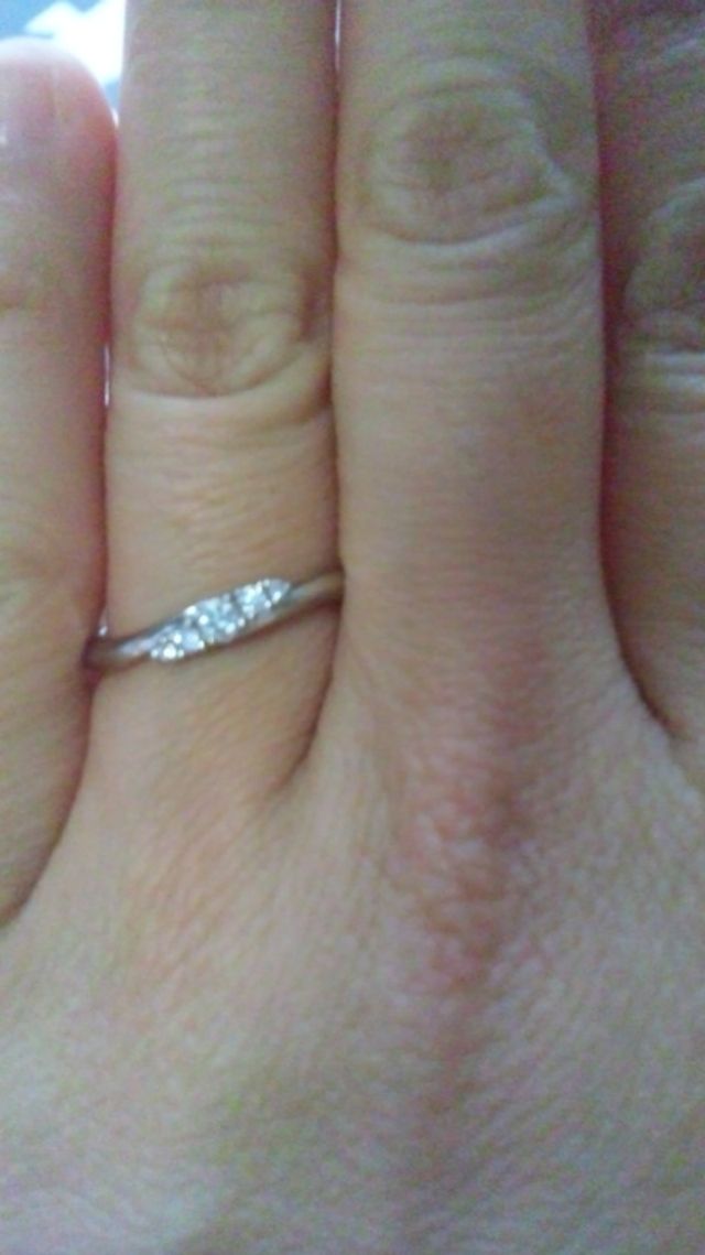 指にはめた状態