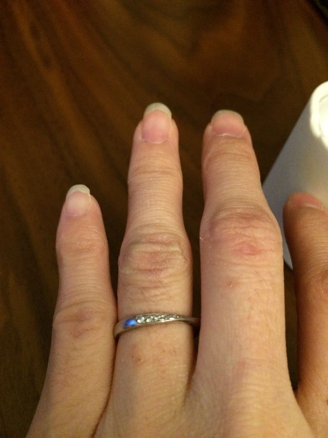 ダイヤは5つです。