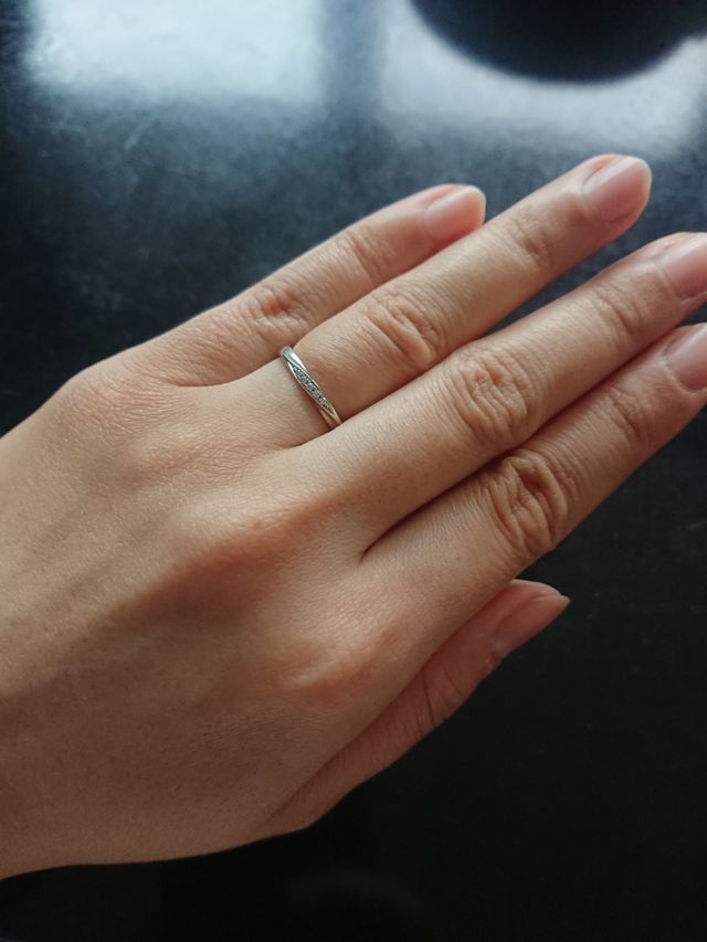 少しむくみ有状態。石は多いがｷﾞﾗｷﾞﾗしない。