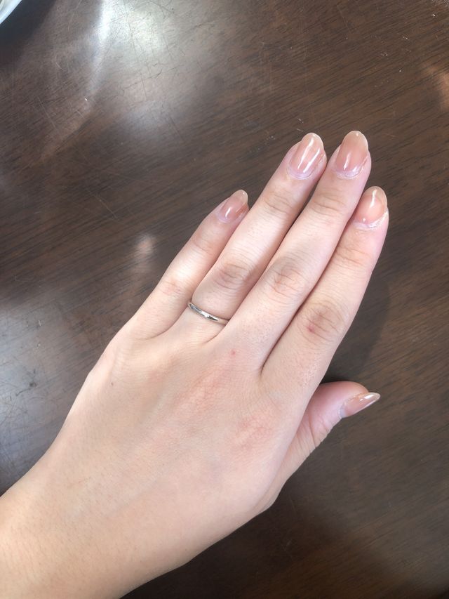 指にお肉がふっくらついてますが指輪が細いので細く見せてくれる