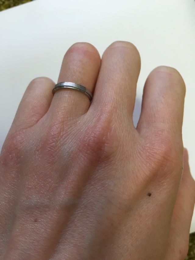 つけた時の写真2