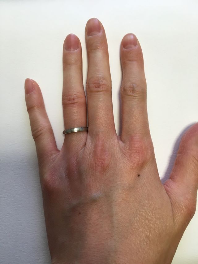 つけた時の写真1