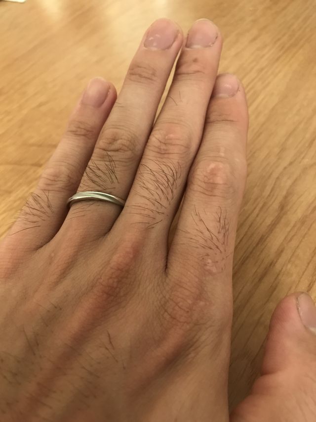 指の毛は見ないフリしてね