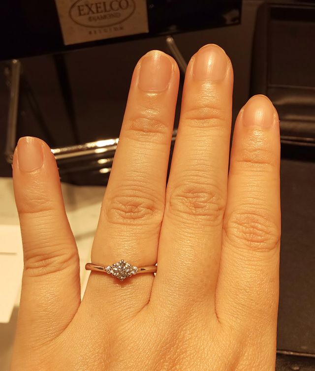 ほんの少しVラインになっていて、指が長く見えます