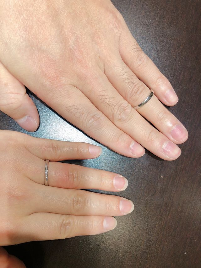 購入したデザインの指輪を着用。サイズ悩みすぎて指が赤い