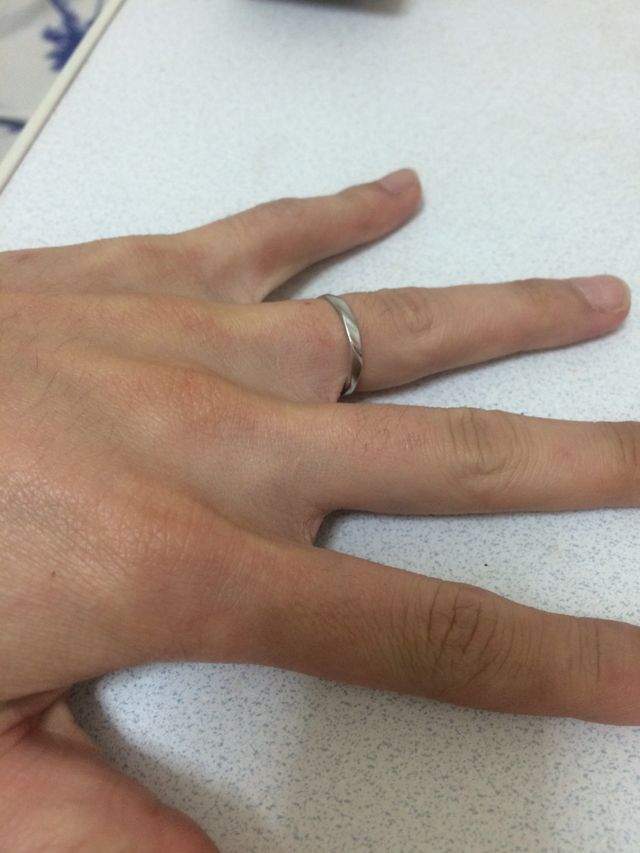 手を使う仕事をしていますが、支障はありません