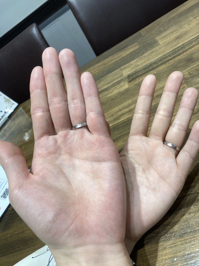 手のひら側から見た場合です。