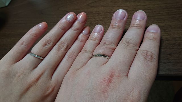 ２人の結婚指輪着用。