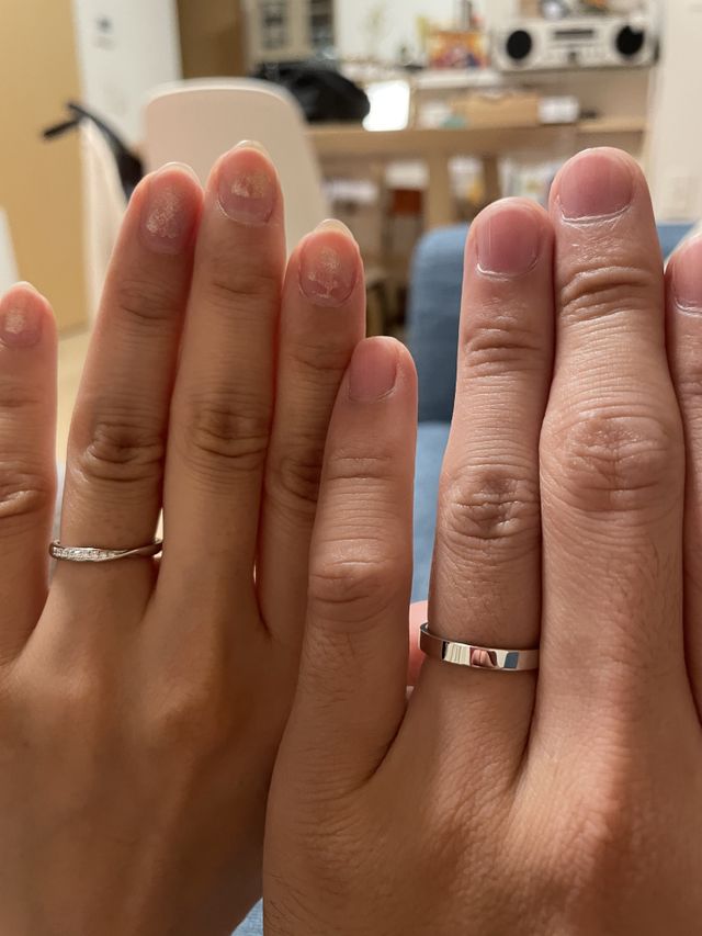 指輪をつけている写真