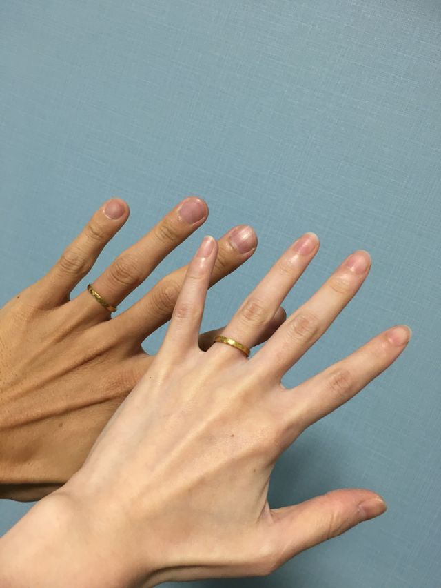 つちめ模様が綺麗に出て、とても素敵な指輪になりました。