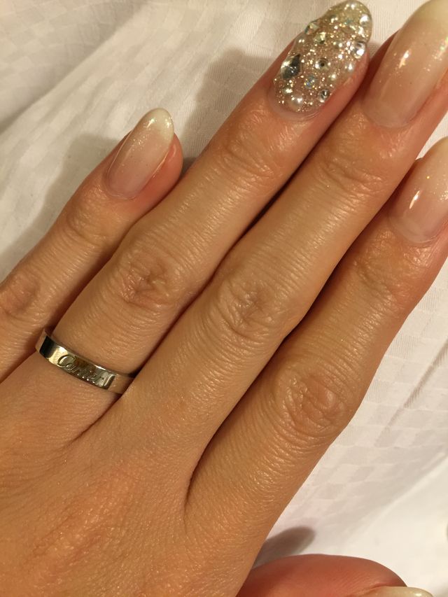 指にはめた状態