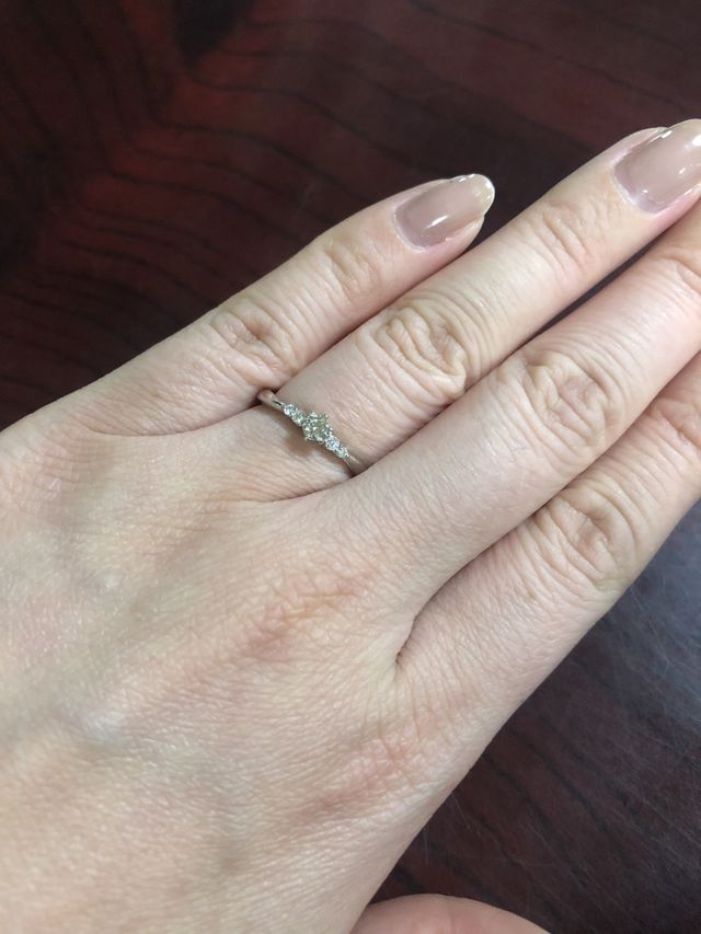 初めて装着した時の写真