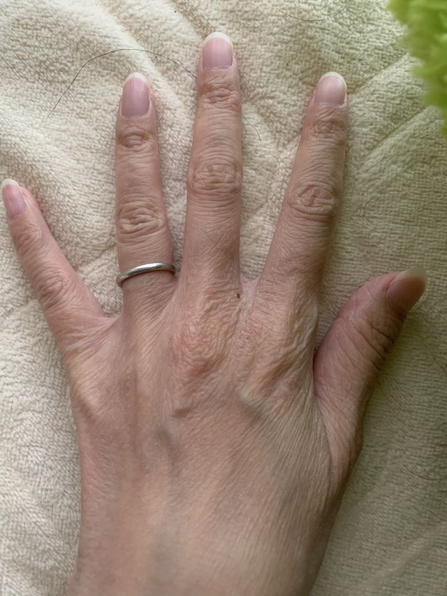 金属アレルギーでも安心して着けることが出来ています