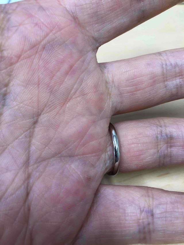 結婚指輪(手のひら側)