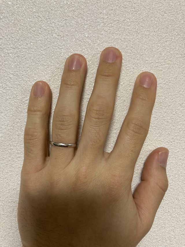 購入から2週間後の写真です。