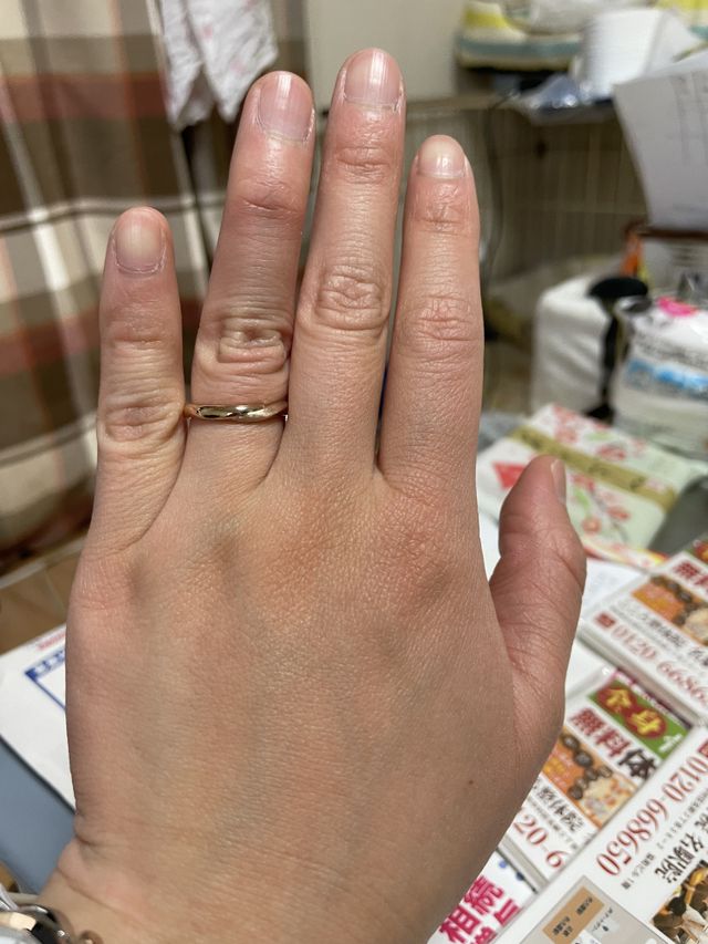 指輪をたけたところです。