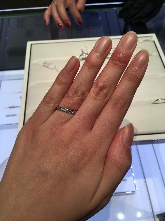 ココクラッシュのダイヤありです。