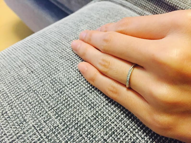 小指側から見た写真です