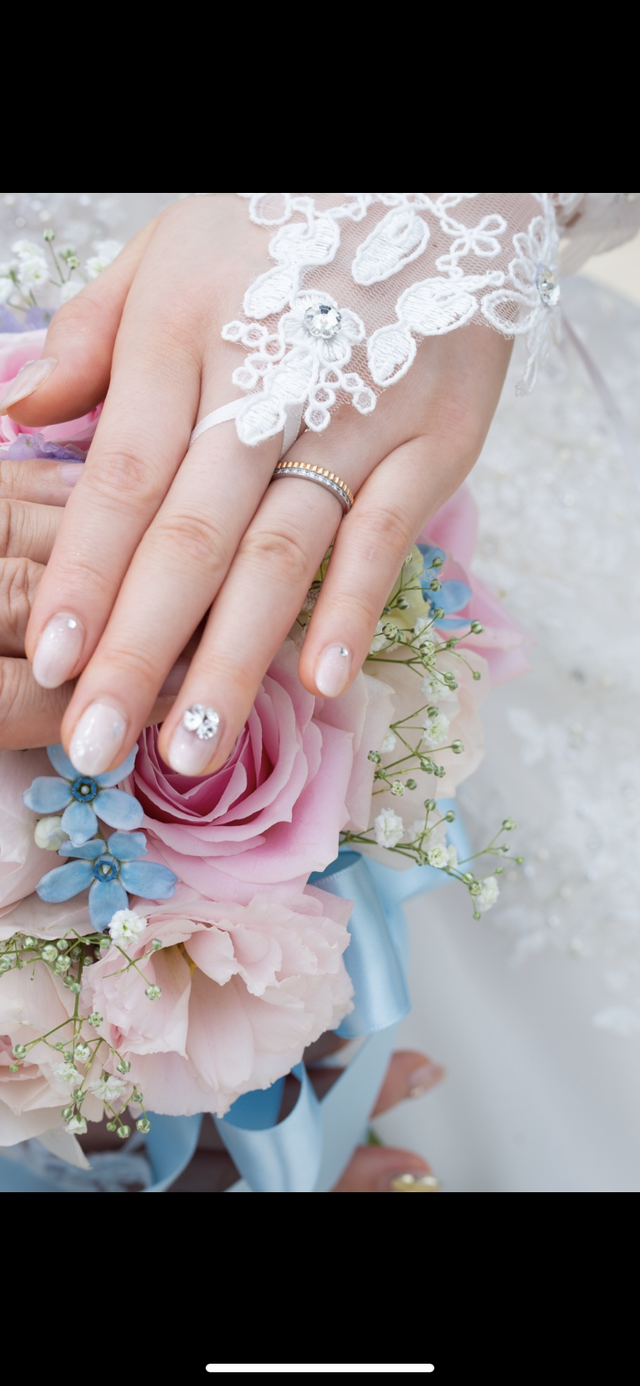 傷は全く目立ちません