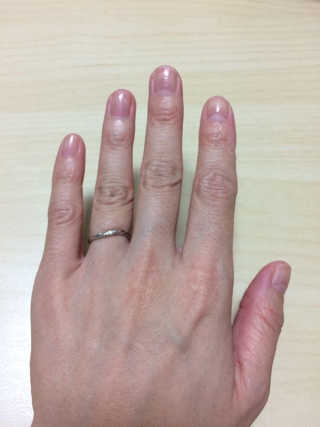 結婚指輪を購入してから約2ヶ月の写真です。