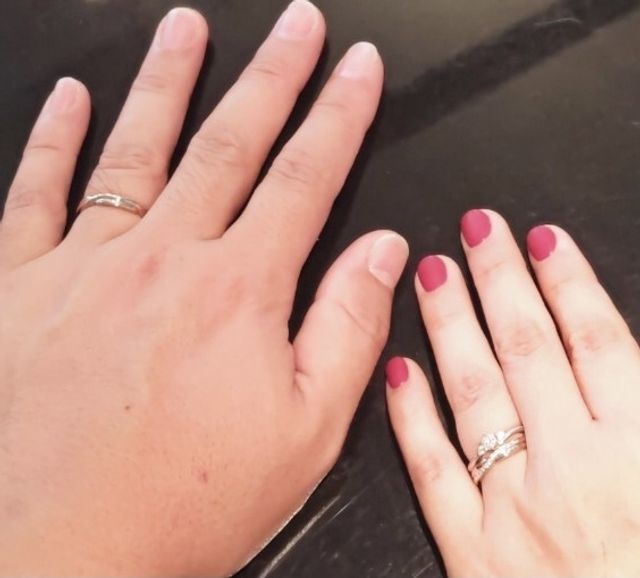 縁のハニーイエローゴールド。