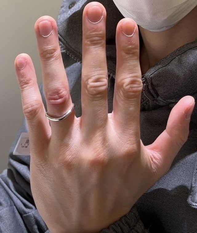 V字型で指が長く見えるタイプです。