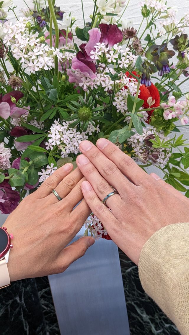 お互いの理想の形が実現しました！ジルコニウムが特徴です。