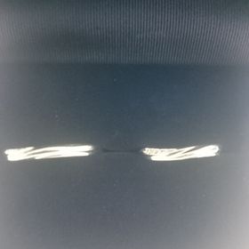 【銀座ダイヤモンドシライシの口コミ】 ウェーブのあるデザインが指にキレイにはえて、気に入っています。キラキ…