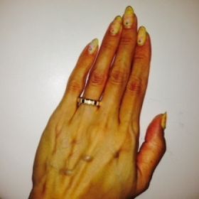 【ショパール(Chopard)の口コミ】 シンプルで手が若く見えるゴールドが欲しいと思っていました。常に付けて…